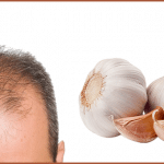 فوائد الثوم في علاج تساقط الشعر